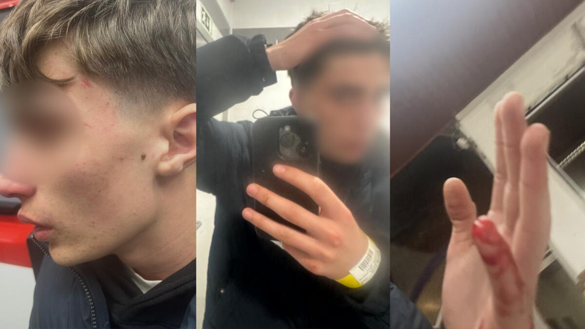 Teen Claims Police Threatened Him Over Marijuana & Instagram Messages