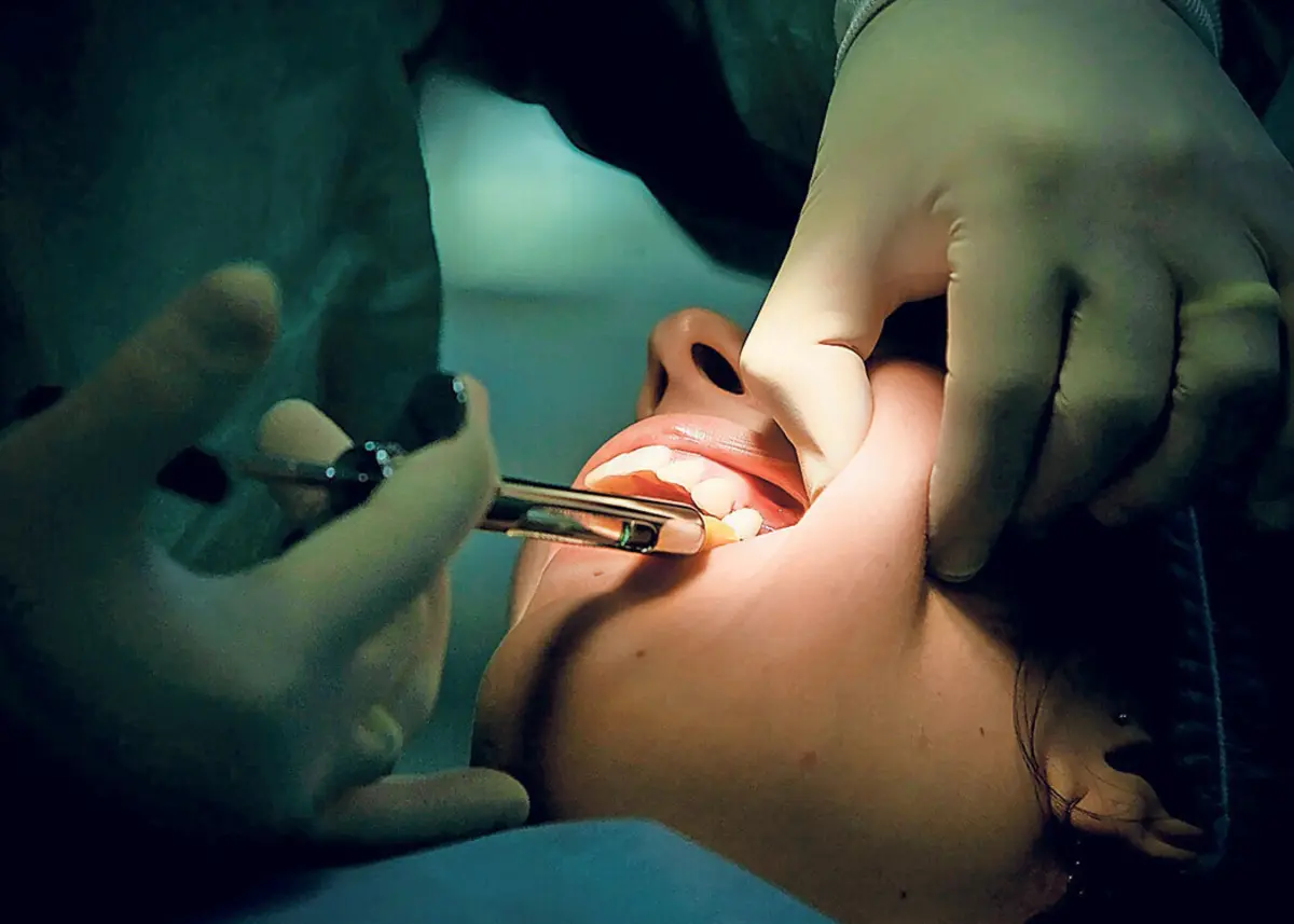 Alguns clientes receberam próteses provisórias, mas nunca as definitivas