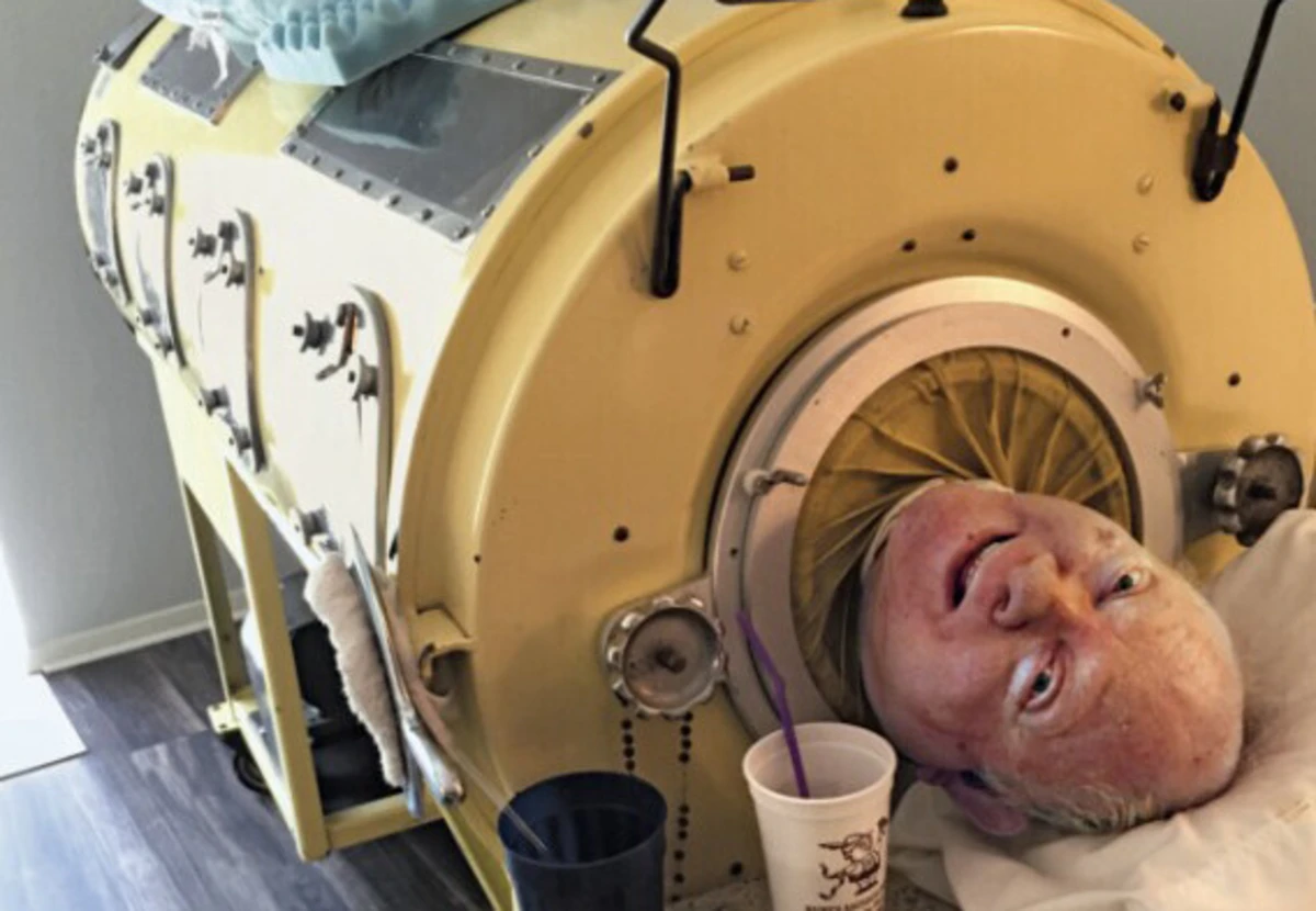 Paul Alexander utilizou uma máquina para ajudá-lo a respirar durante 70 anos