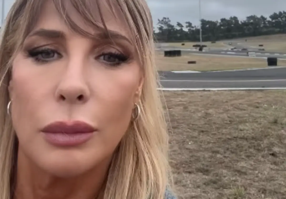 Imagem de contexto do artigo Cirurgião plástico analisa técnica de rejuvenescimento de Alexandra Lencastre