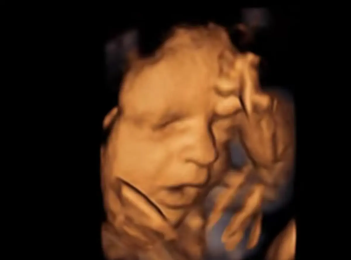 Imagem de contexto do artigo "Exposição desnecessária do feto": regulador alerta para riscos das "ecografias emocionais"