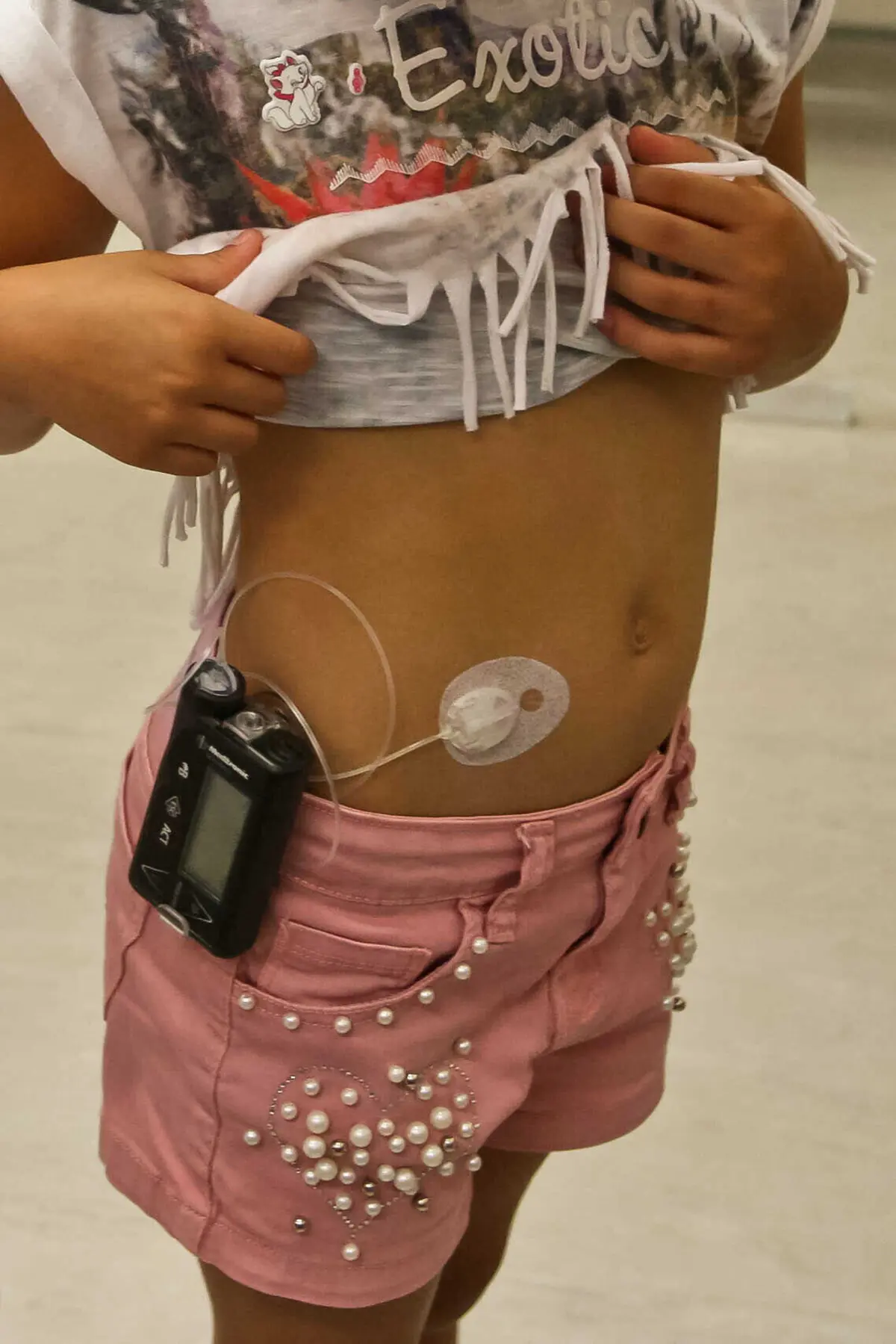 Os países em desenvolvimento "registaram os maiores aumentos"