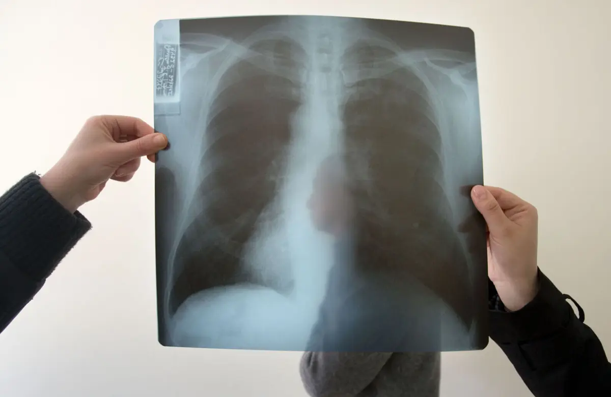 Imagem de contexto do artigo Aparelhos de raio-x obsoletos colocam em risco exames