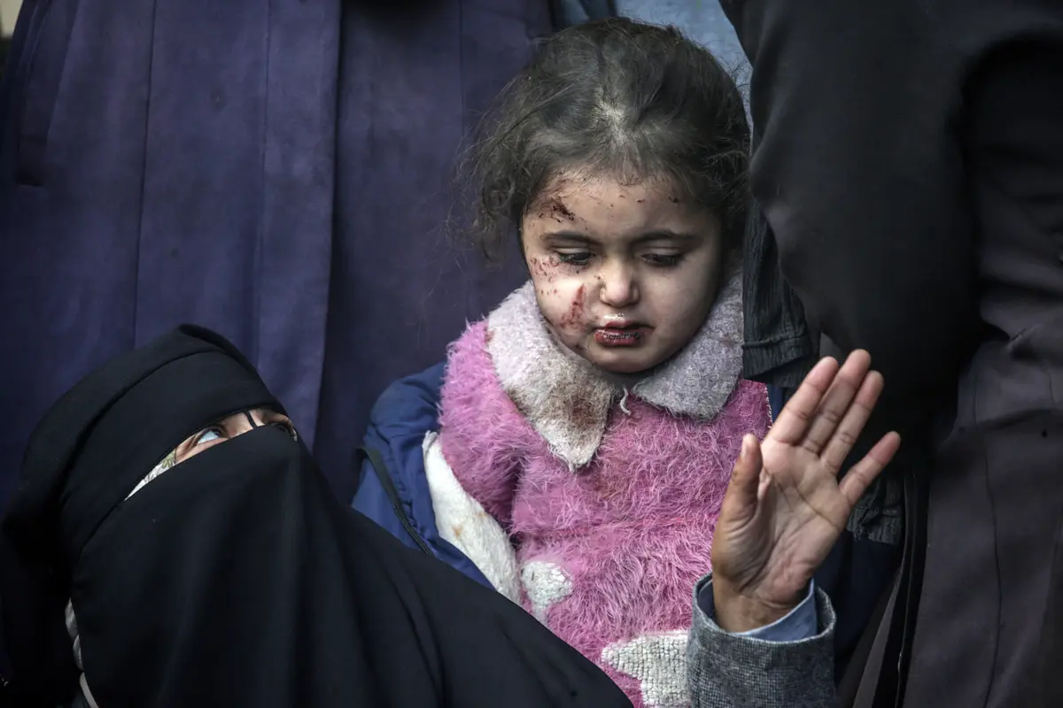 Criança palestiniana ferida em Deir al-Balah, na Faixa de Gaza