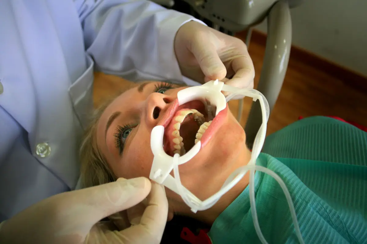 Ordem alerta para casos graves de autotratamento e pede regulamentação de alinhadores de dentes