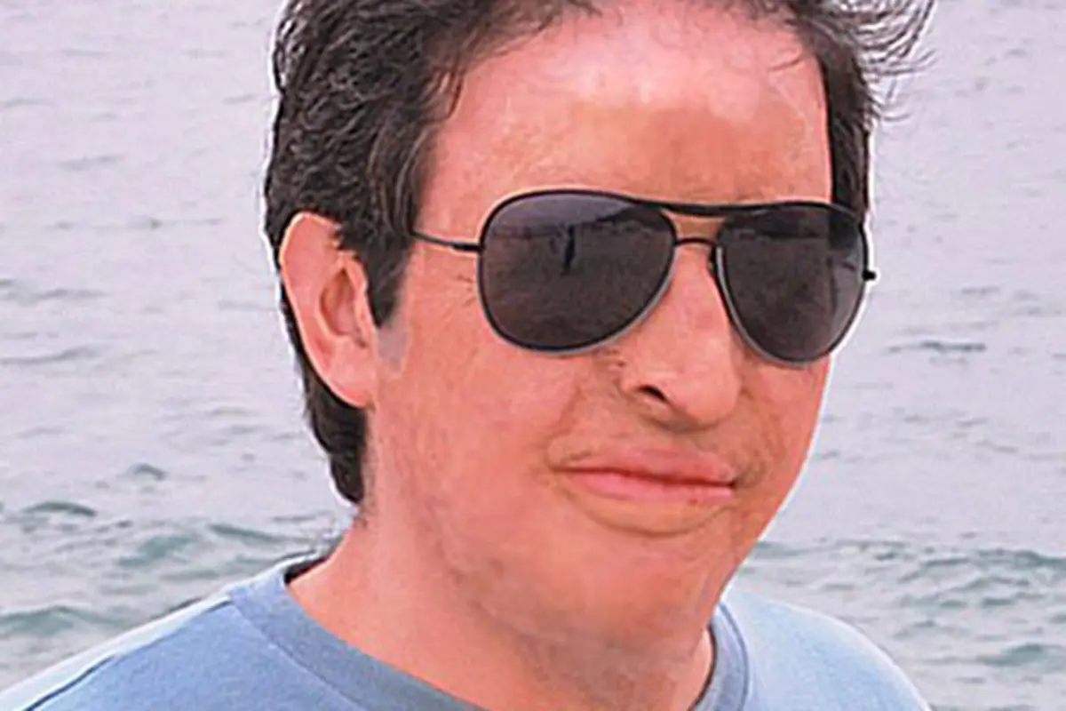 Paulo Renato tinha sobrevivido a um incêndio em 1985