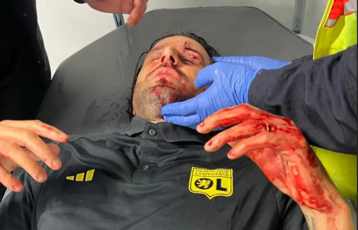 Fabio Grosso ficou ferido