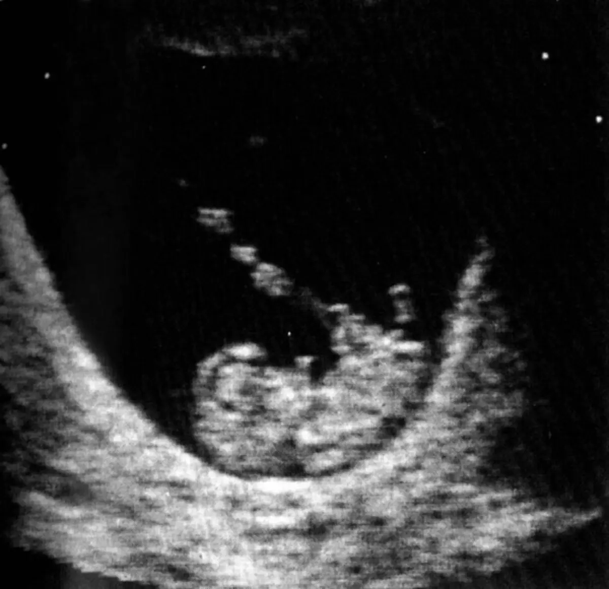 Hospital de Aveiro com constrangimentos na realização de ecografias a grávidas