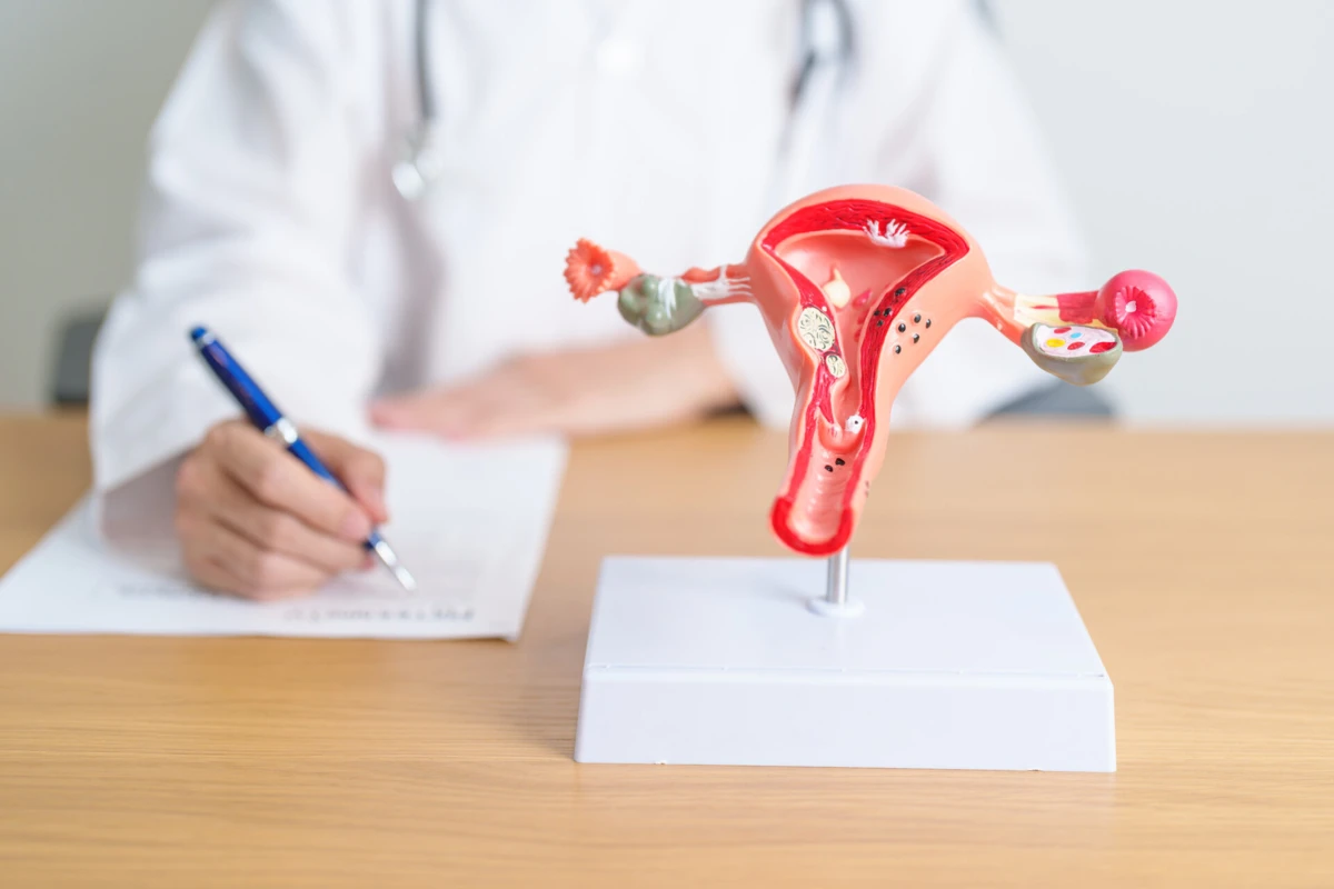 Imagem de contexto do artigo Cancro do endométrio e do ovário: aposta na literacia