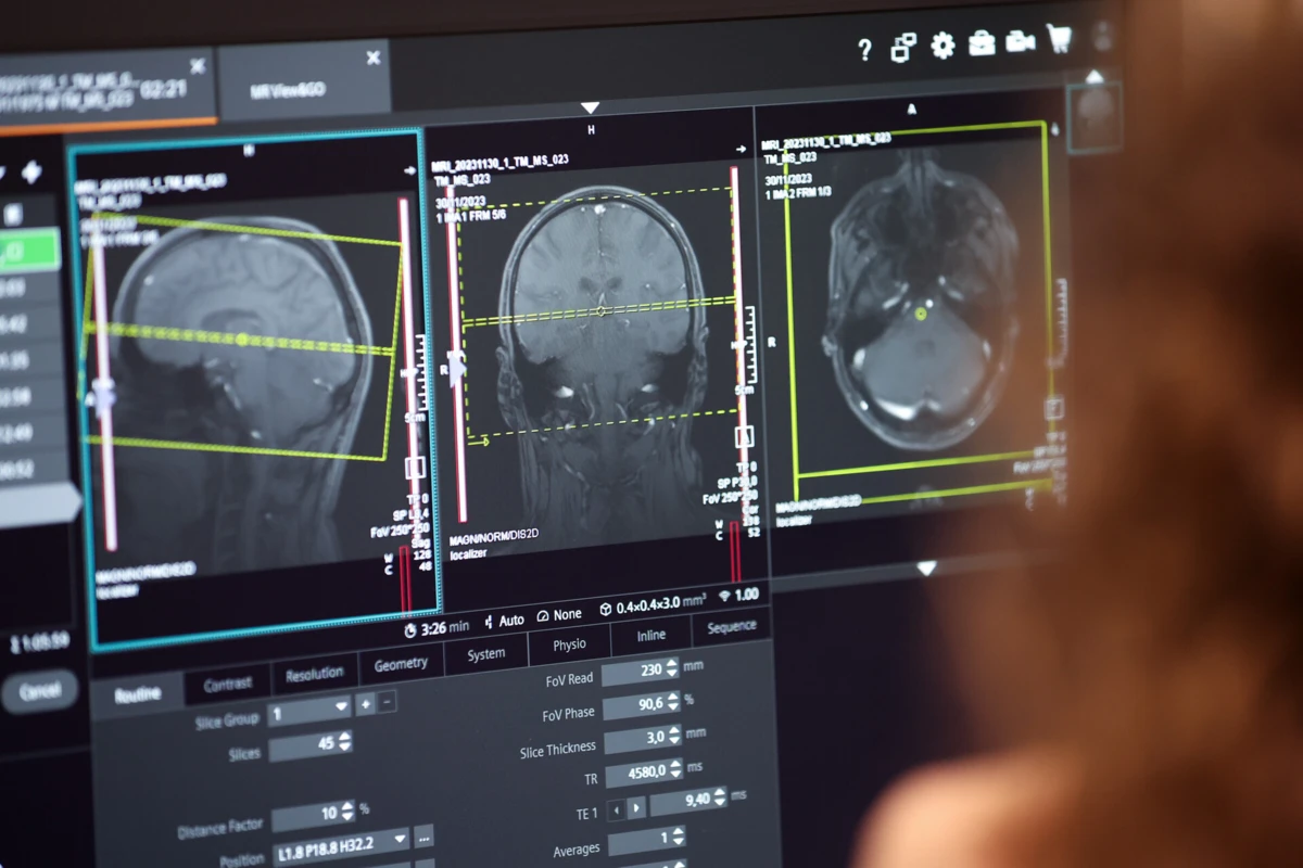 Há cerca de quatro mil doentes que vovem com a doença em Espanha
