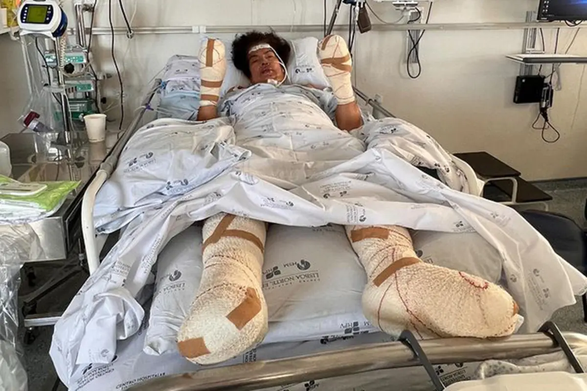 Os membros superiores continuam em observação