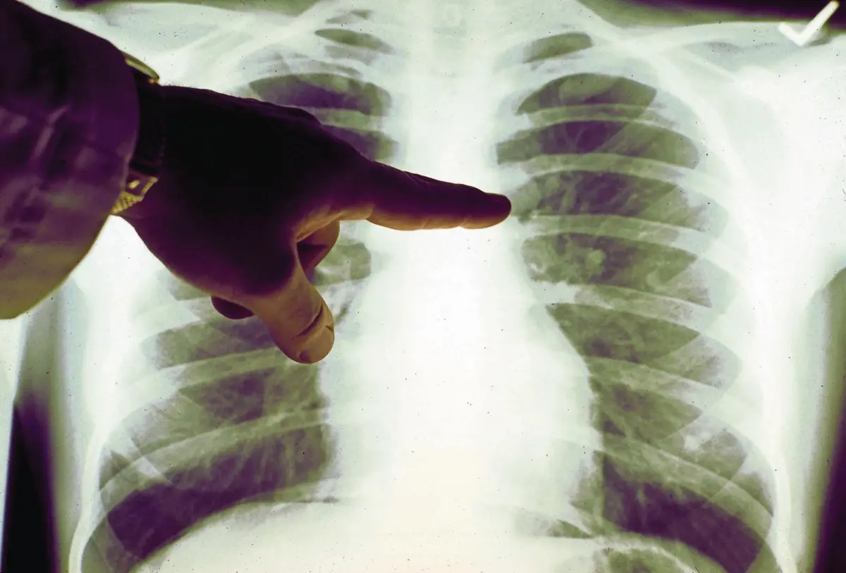 Todos os dias, há 191 pessoas que recebem o diagnóstico de cancro em Portugal