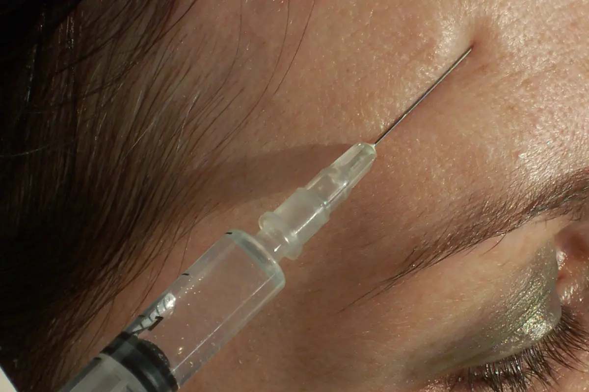 Imagem de contexto do artigo "Peelings" e botox pagam 23% de IVA mesmo que feitos por médico