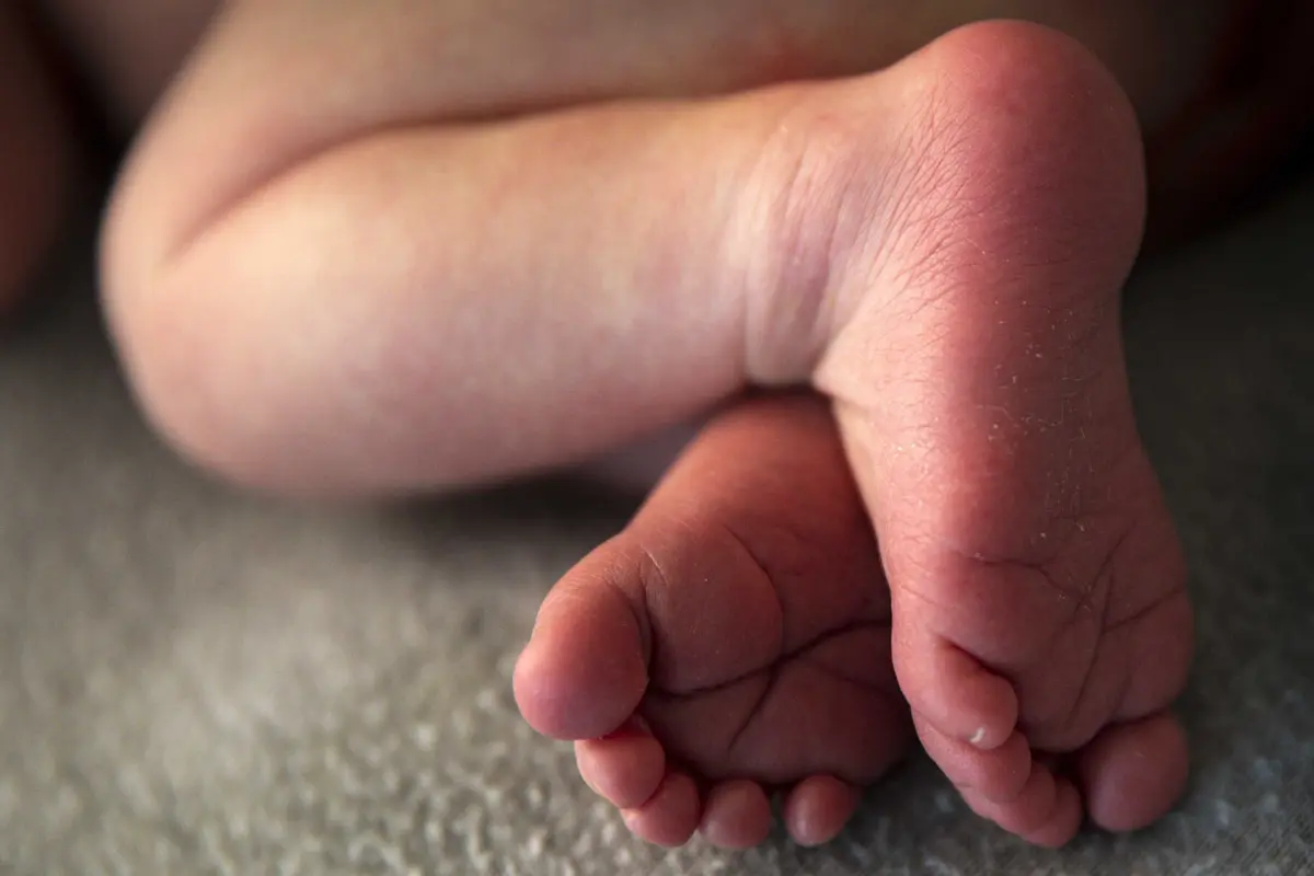 Imagem de contexto do artigo Portugal tem a maior prevalência da "Doença dos Pezinhos" do mundo