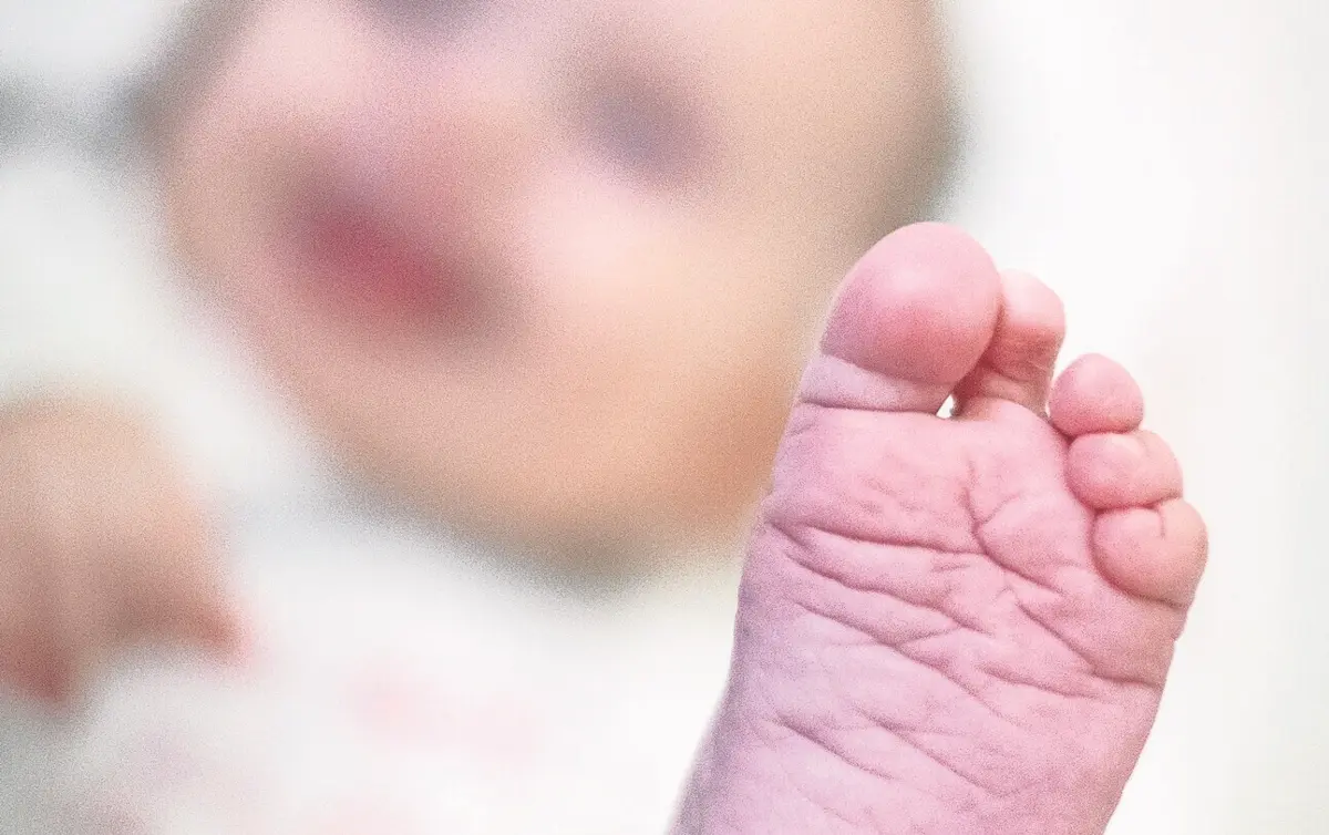 Terapia dos bebés com atrofia muscular espinhal (AME) fica muito cara e não tem comparticipação