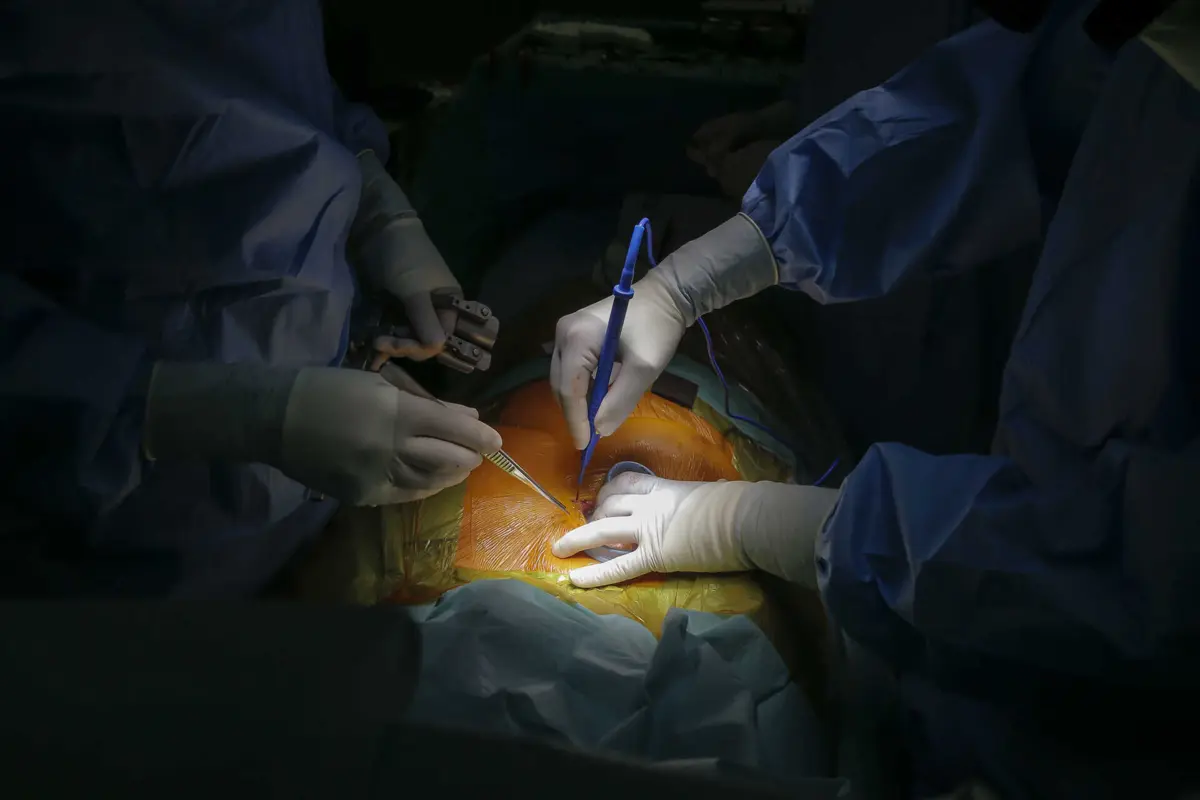 Hospitais do SNS realizaram 58 transplantes de coração superando o recorde atingido em 2013