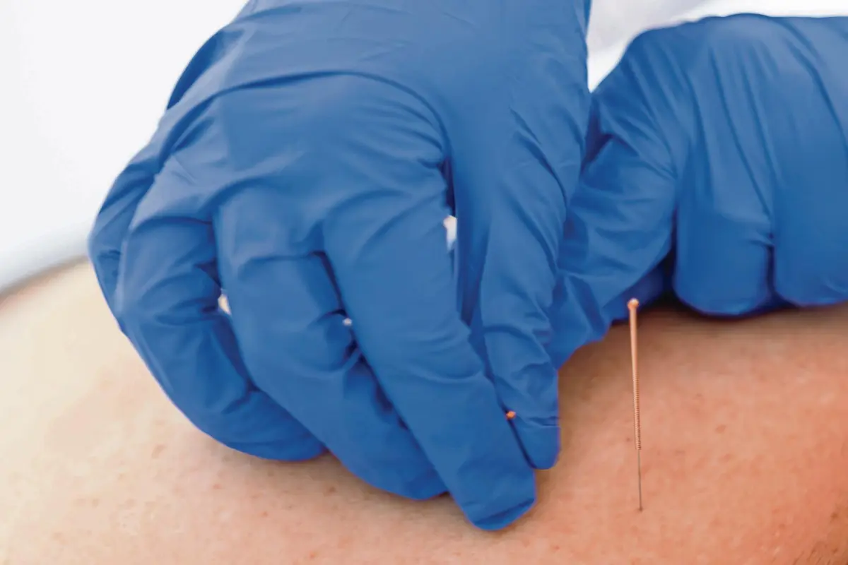 Profissionais falam numa "injustiça" na lei