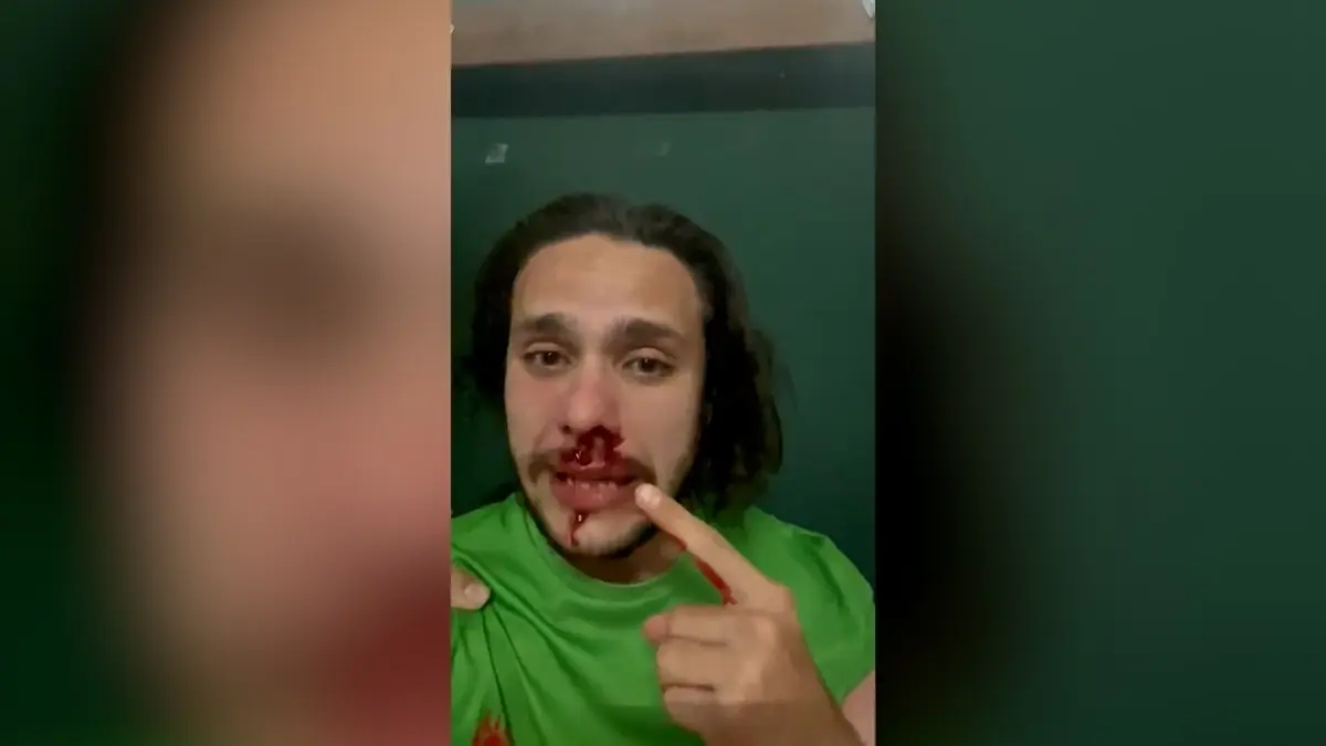 Rafael Busqueti foi agredido em abril de 2023