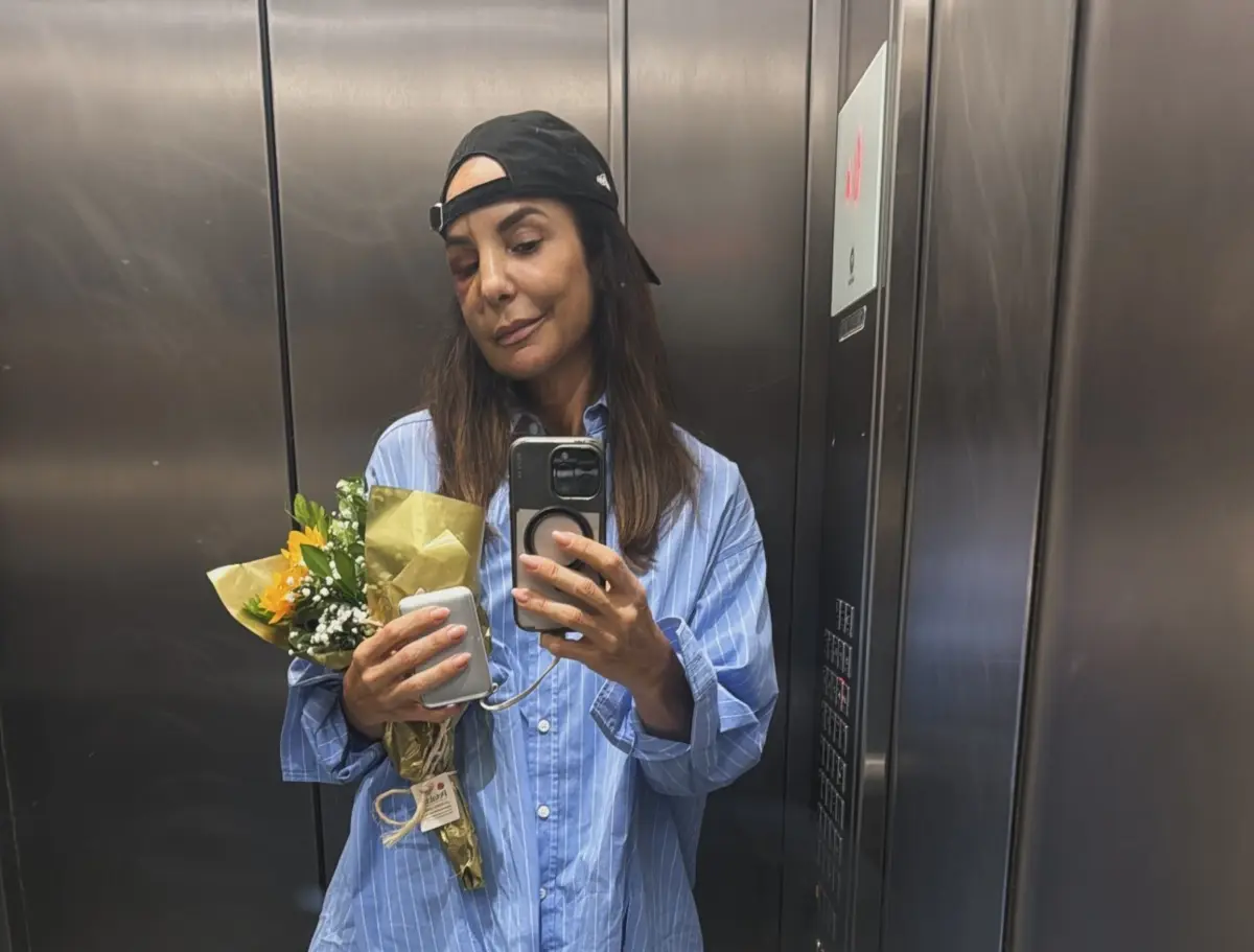 Ivete Sangalo desmaiou e bateu com o rosto no chão durante o Carnaval