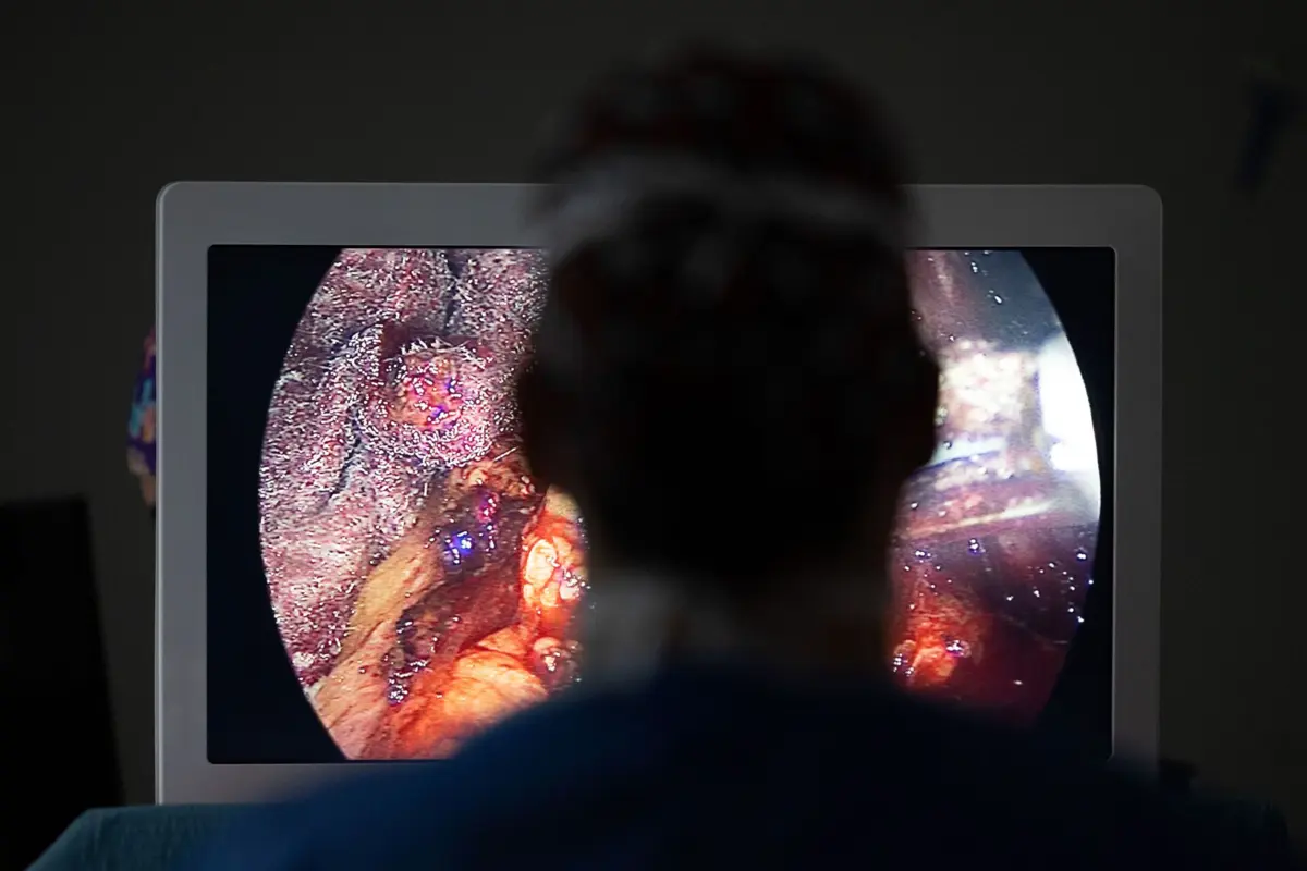 Foram utilizados dois robôs cirúrgicos em simultâneo