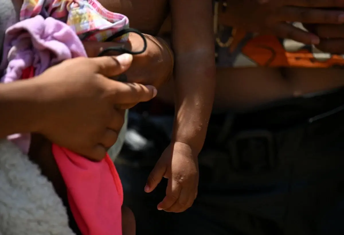 Imagem de contexto do artigo Algoritmos da OMS podem duplicar número de crianças diagnosticadas com tuberculose