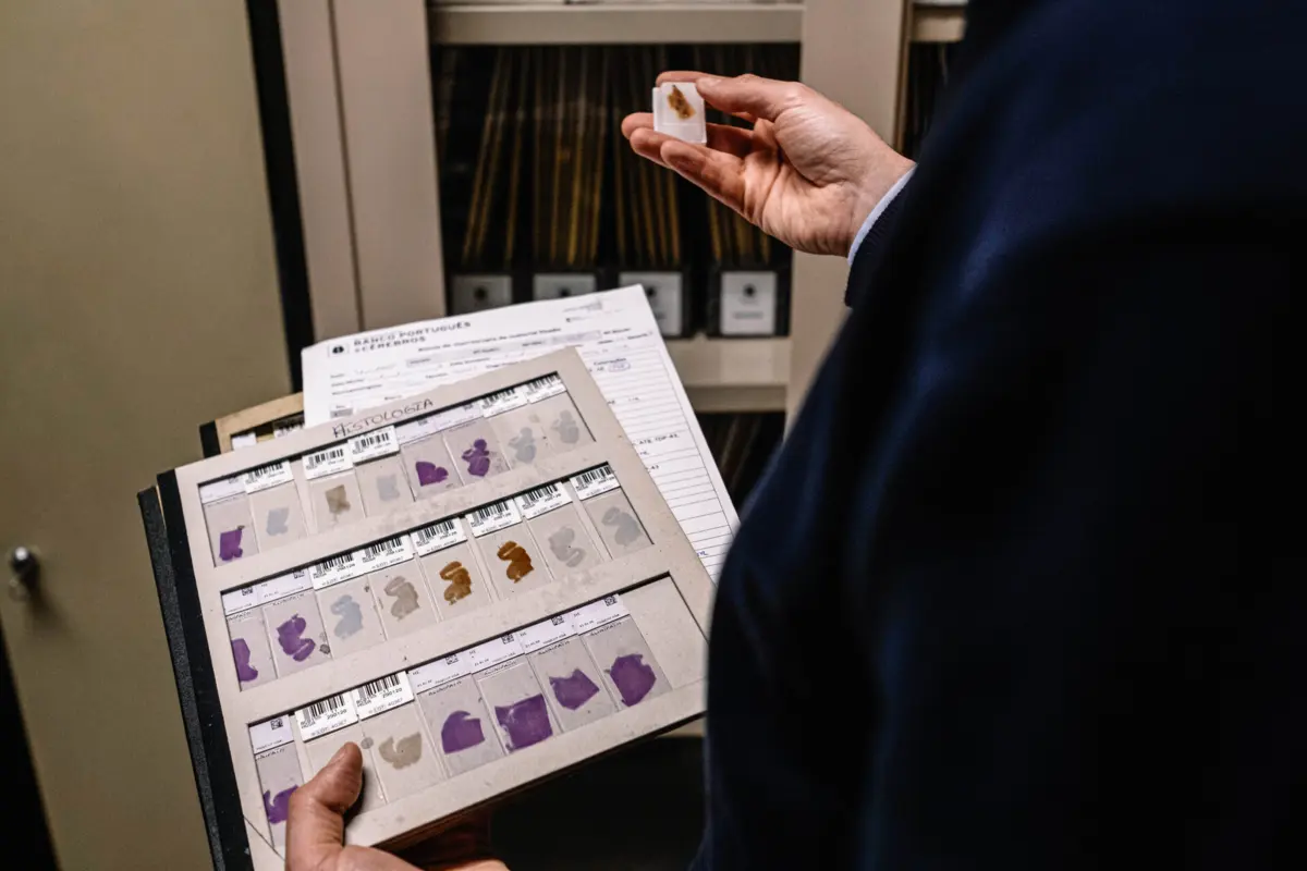 Imagem de contexto do artigo Descoberto novo tipo de células cerebrais promissoras para combater Alzheimer e Parkinson