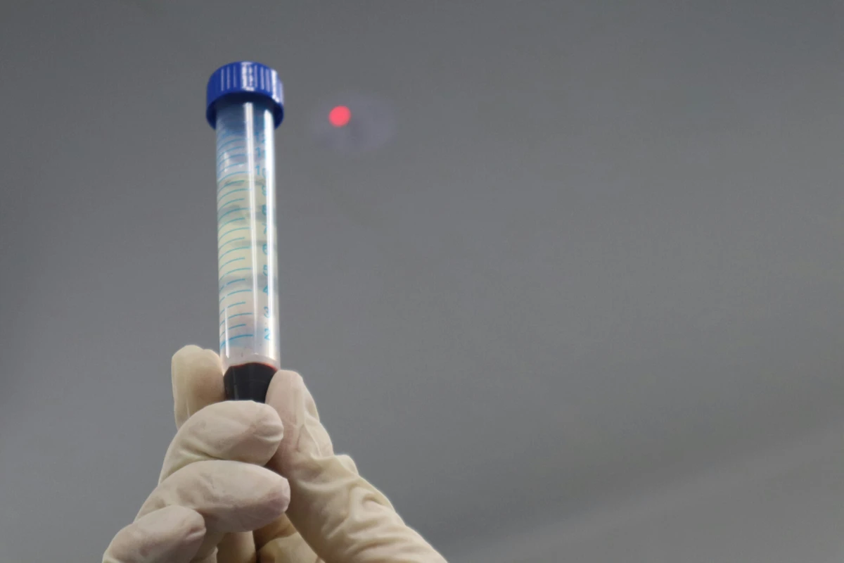 Imagem de contexto do artigo Análise ao sangue poderá substituir amostras de medula óssea na deteção da leucemia