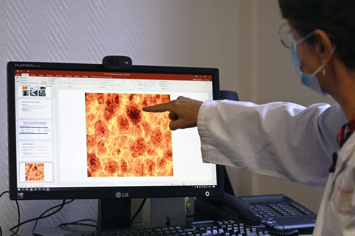 Imagem de contexto do artigo Tecido adiposo mostra tendência para diabetes antes de a doença se instalar