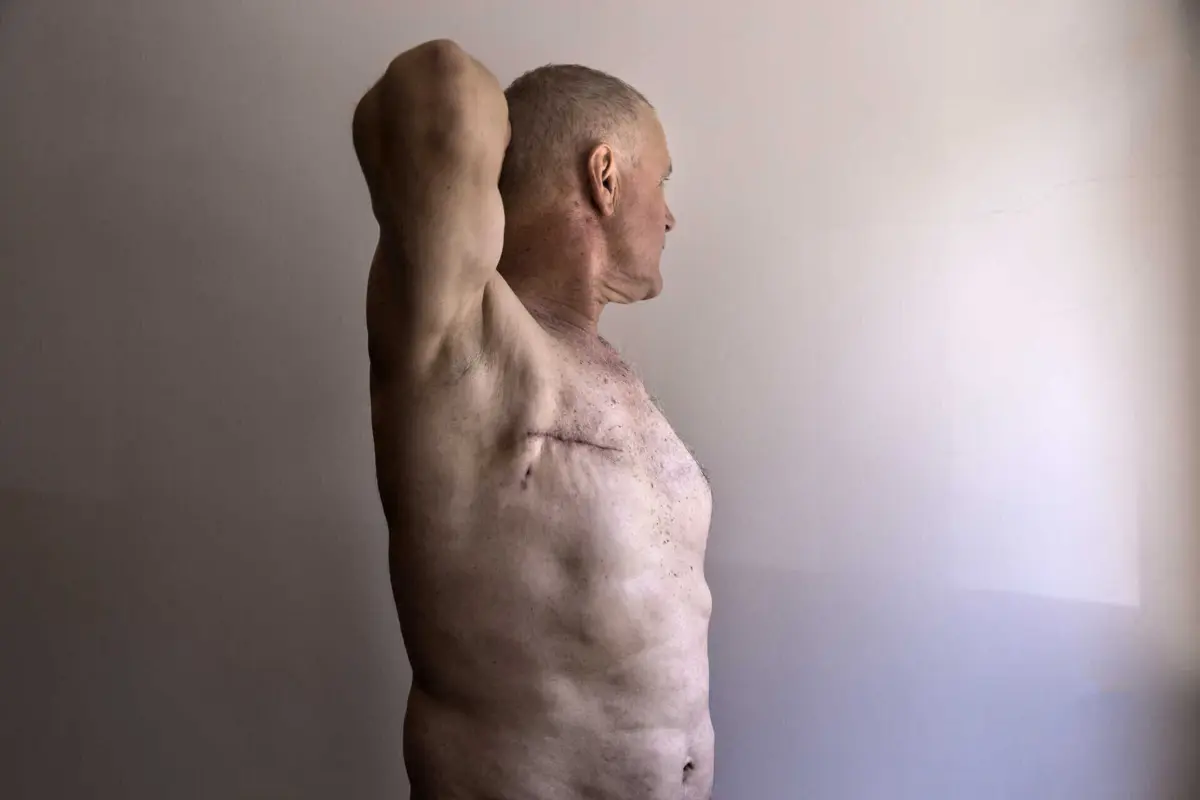 Ainda há desconhecimento sobre o cancro da mama nos homens