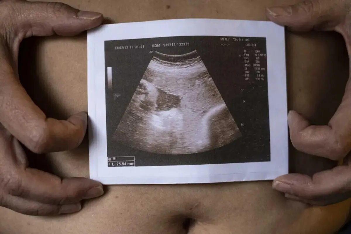 Imagem de contexto do artigo CDS e Chega querem alargar período de reflexão no aborto