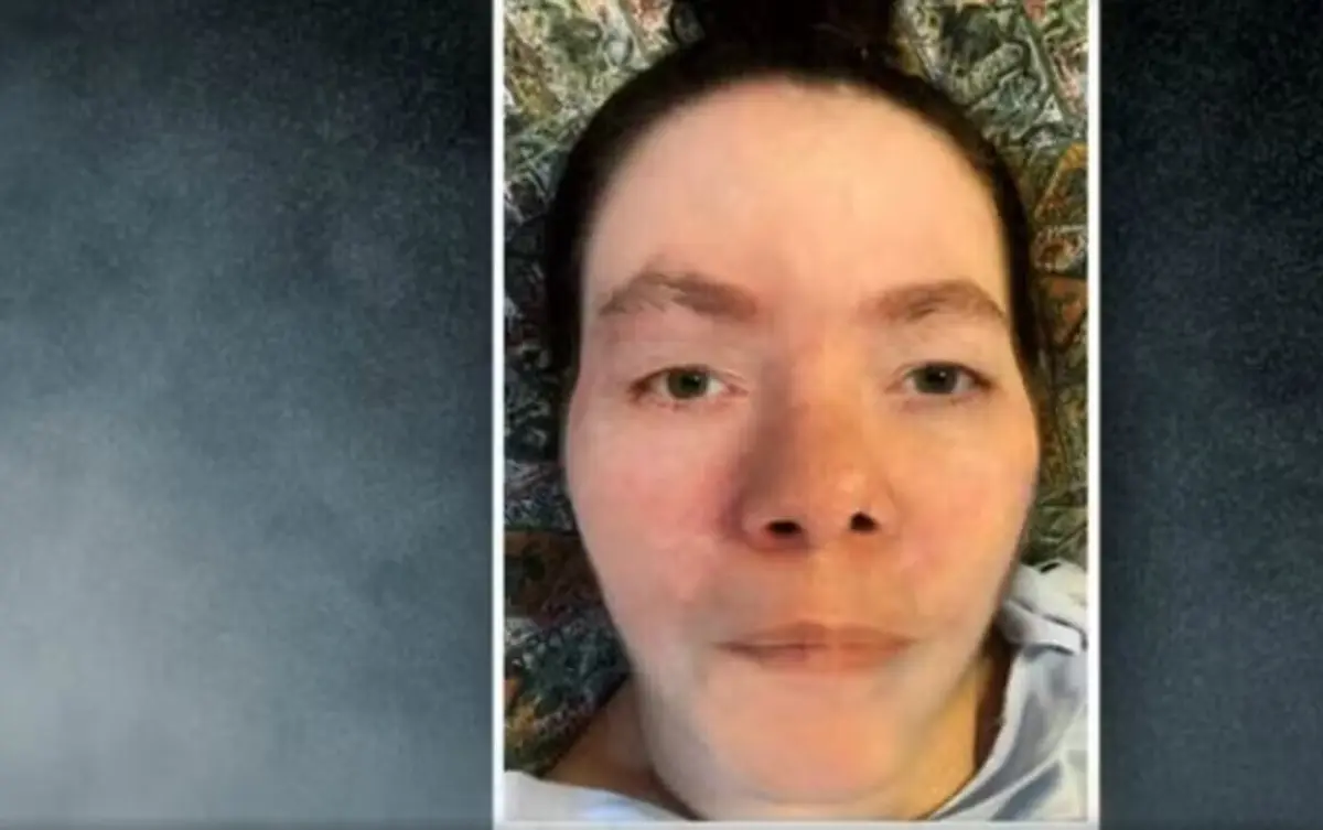 A polícia fez uma simulação de como seria o rosto do paciente