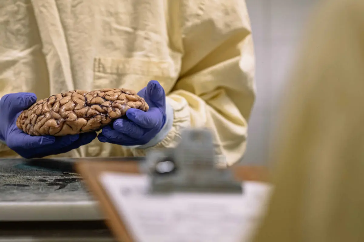 Imagem de contexto do artigo Microplásticos podem acumular-se mais no cérebro do que nos rins ou no fígado