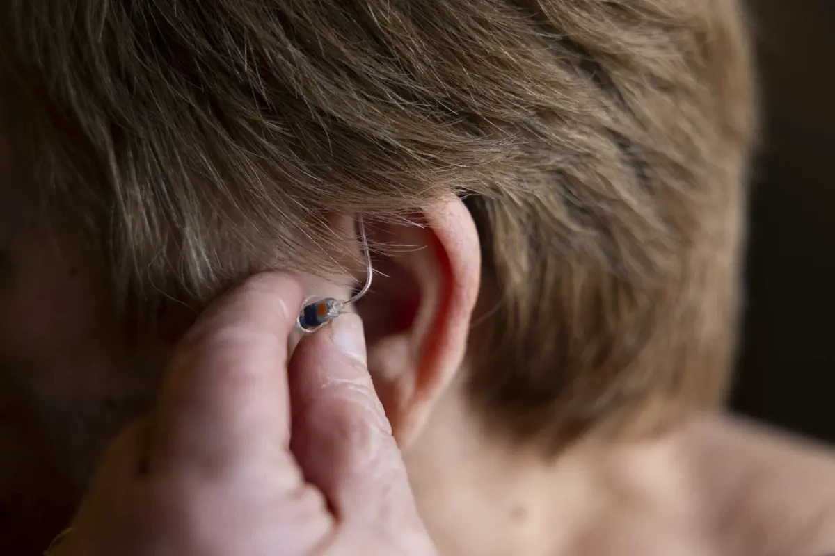 No caso dos implantes cocleares e osteointegrados, o SNS cobre integralmente os custos. Mas o cenário é diferente para os aparelhos auditivos
