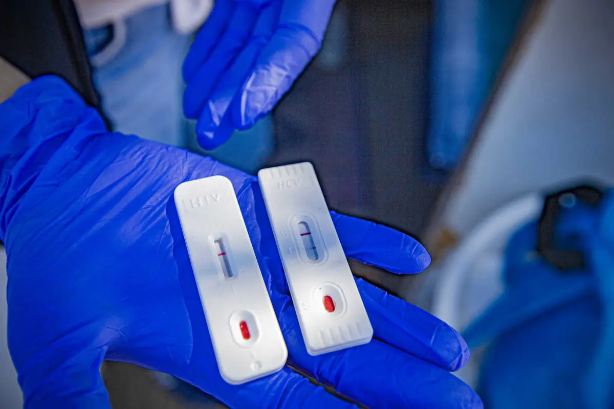 Nem a pandemia travou subida de casos de sífilis