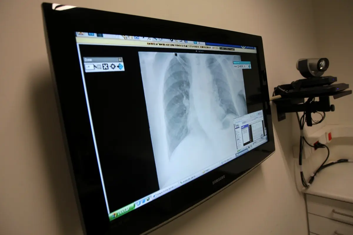 ERS apurou que 34,5% dos estabelecimentos não procedia ao registo da informação resultante da teleconsulta