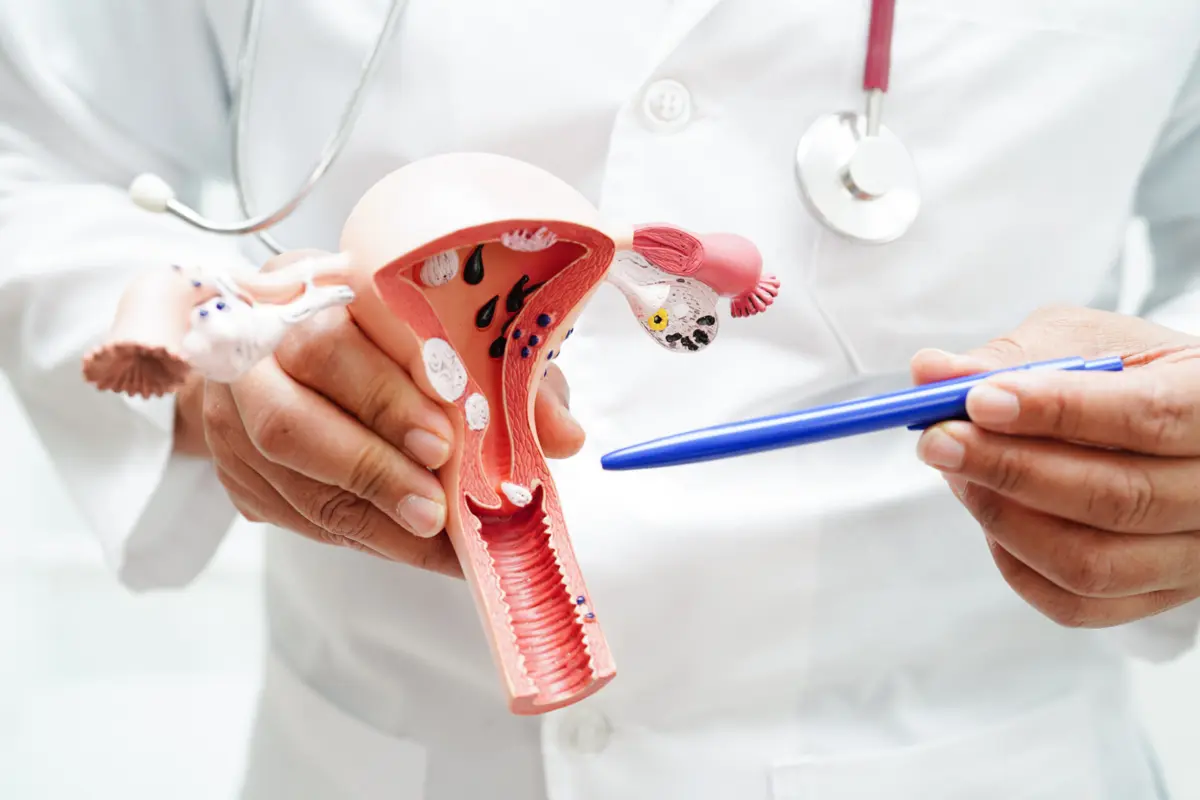 Imagem de contexto do artigo Desafios e Compromissos: perspetivas no combate ao cancro do ovário