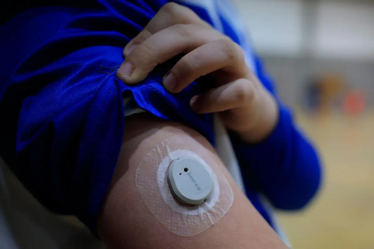 Aparelho no braço para medir a glicose