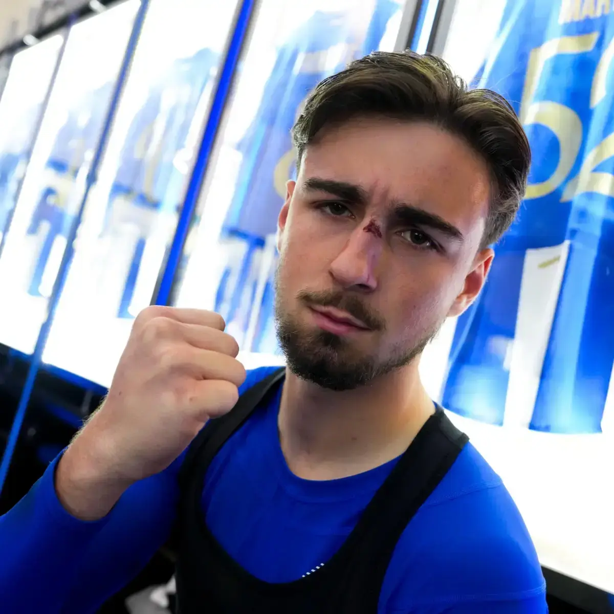 Martim Fernandes jogou o clássico quase todo de nariz partido