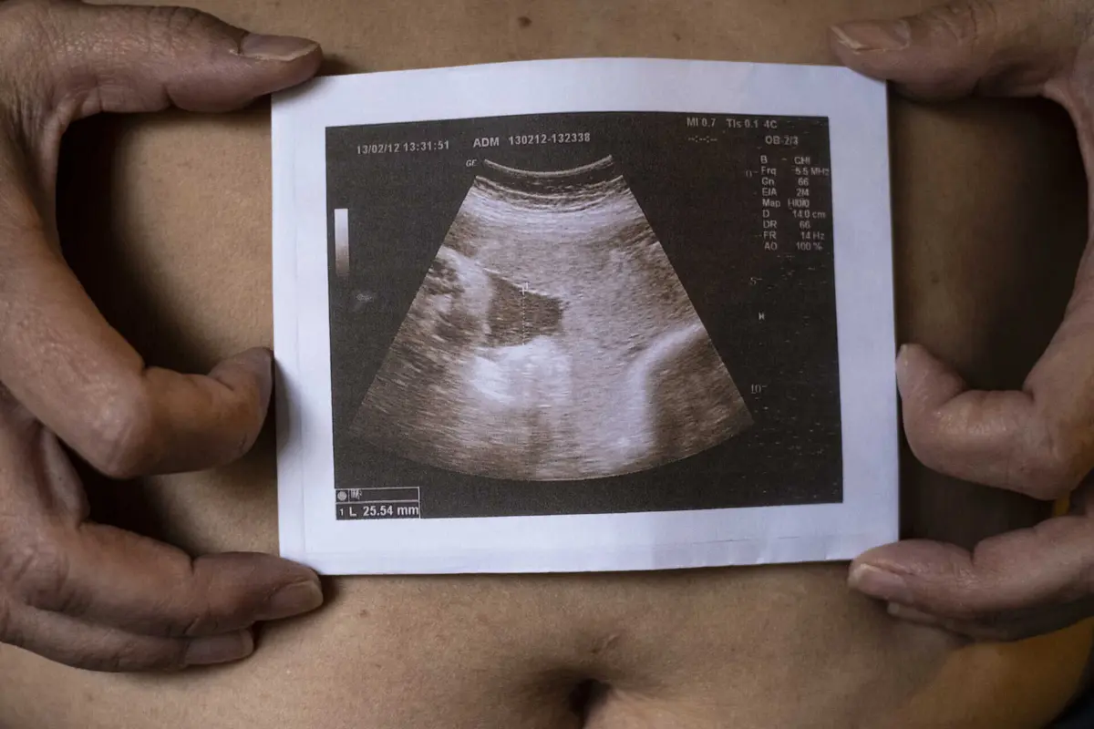 Supremo Tribunal norte-americano revogou direito ao aborto no verão de 2022