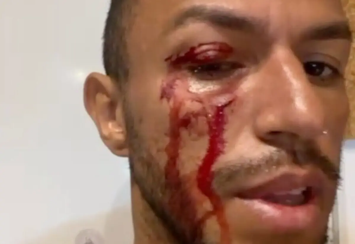 Vítor Constant garante ter levado um murro