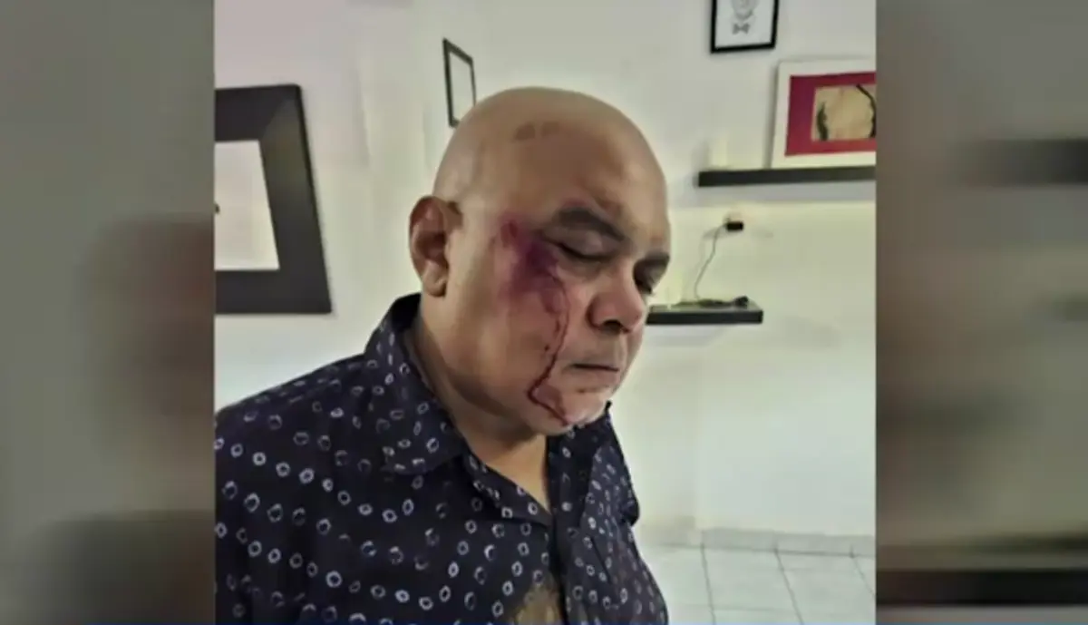 Waldir Araújo relatou que foi agredido por motivações políticas