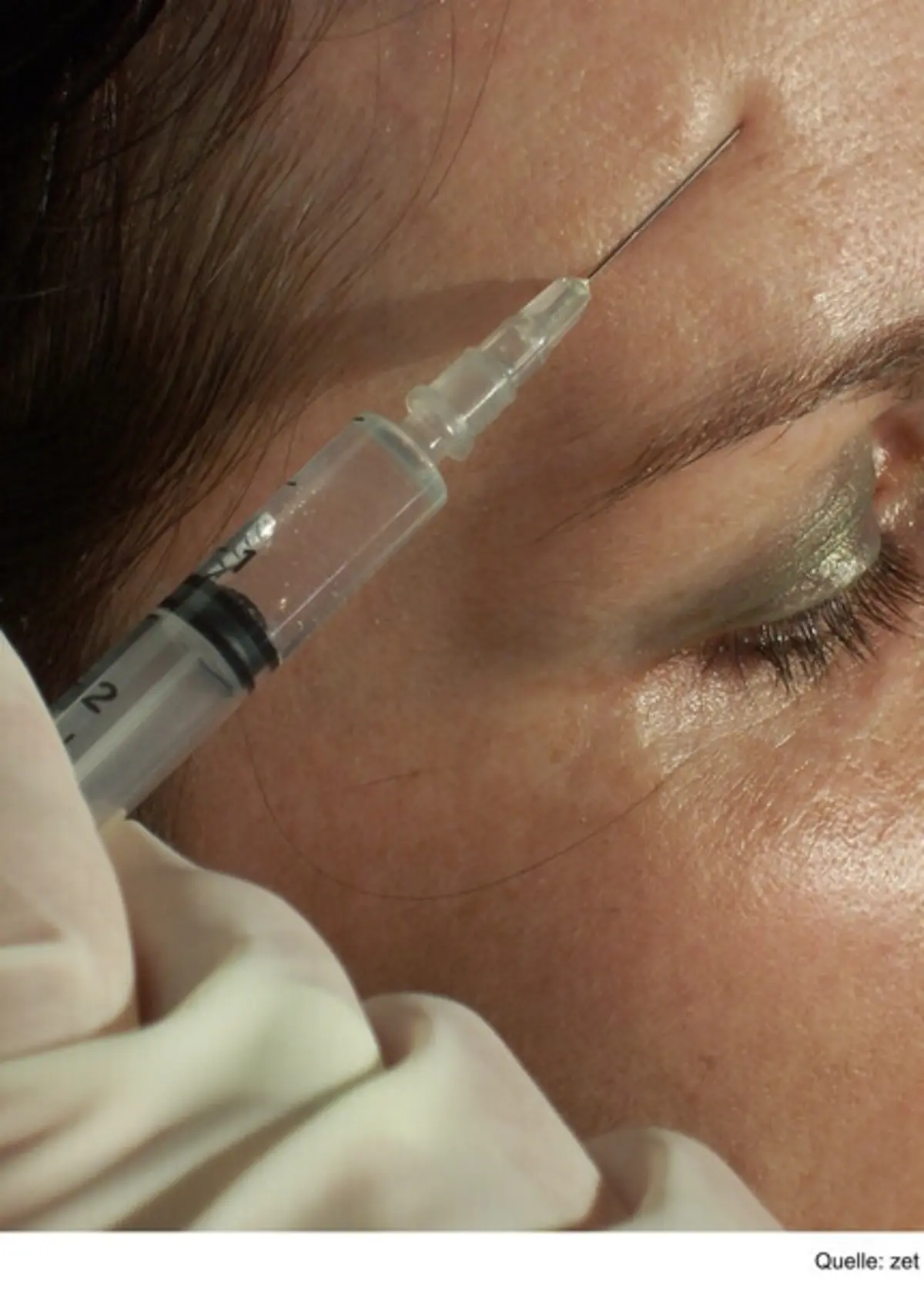 Injeções de botóx entre os tratamentos realizados por profissionais não habilitados