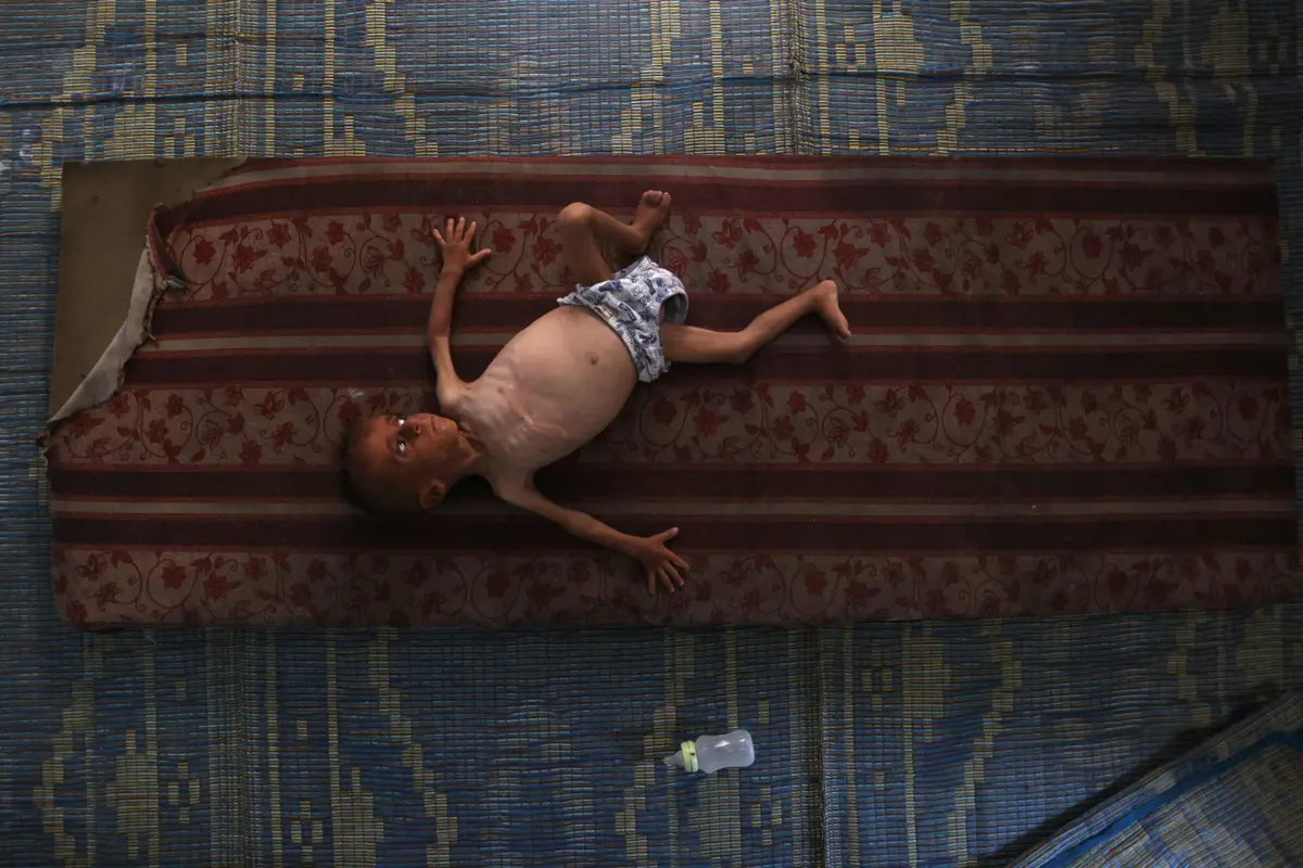 Mohammed al-Mutawaq, de 18 meses, no campo de refugiados de Al-Shati