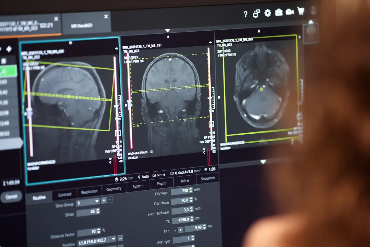 Imagem de contexto do artigo Cérebro passa por cinco fases na vida: saiba em qual está