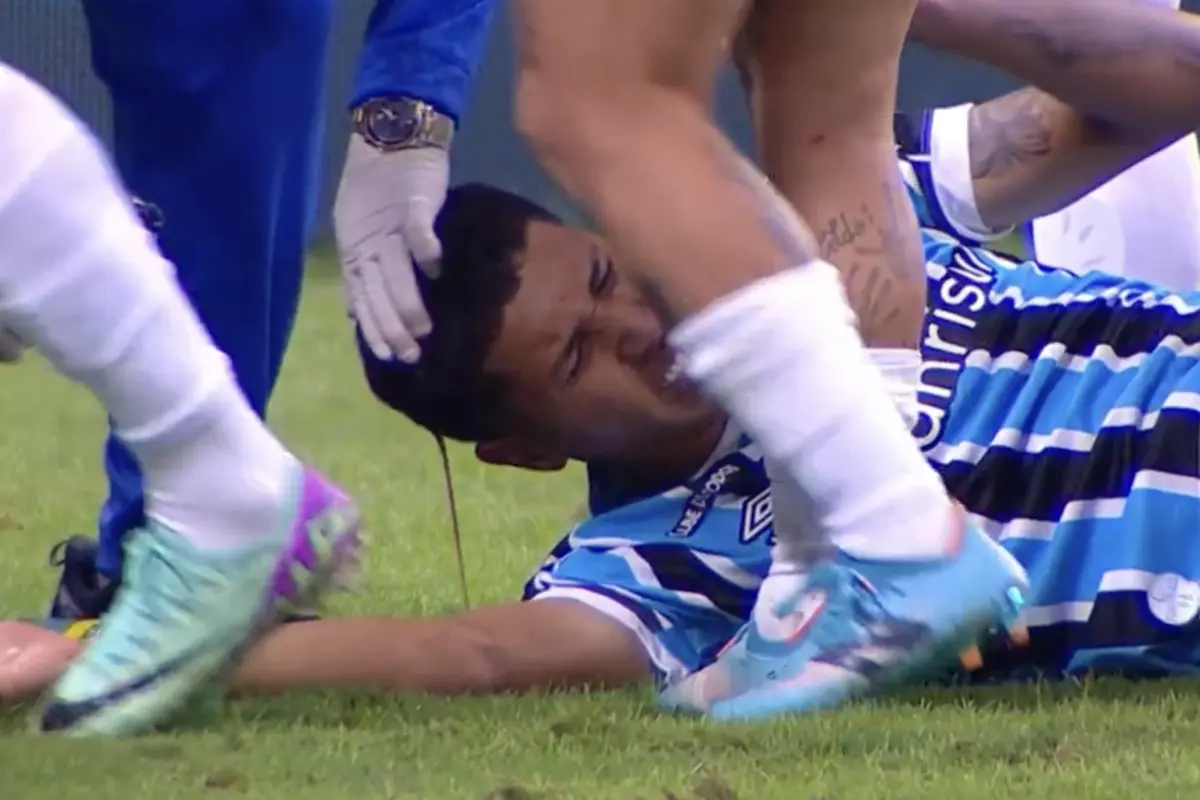 Imagem de contexto do artigo Impressionante: jogador do Grémio fica a sangrar de forma abundante após choque de cabeças
