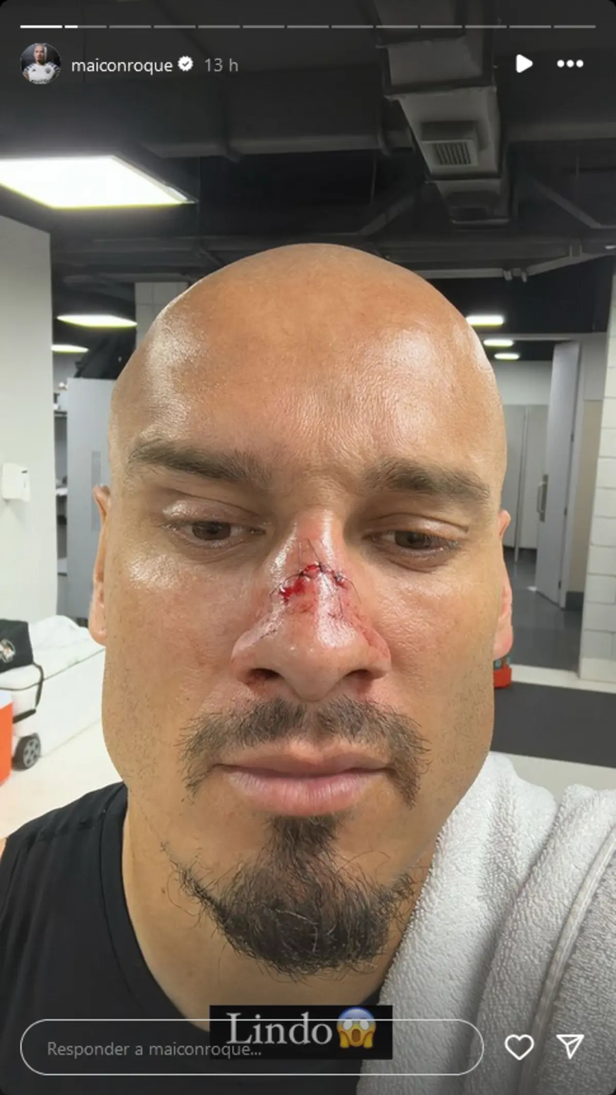 Imagem de contexto do artigo Maicon mostra o nariz partido: "Deu o sangue pela qualificação"