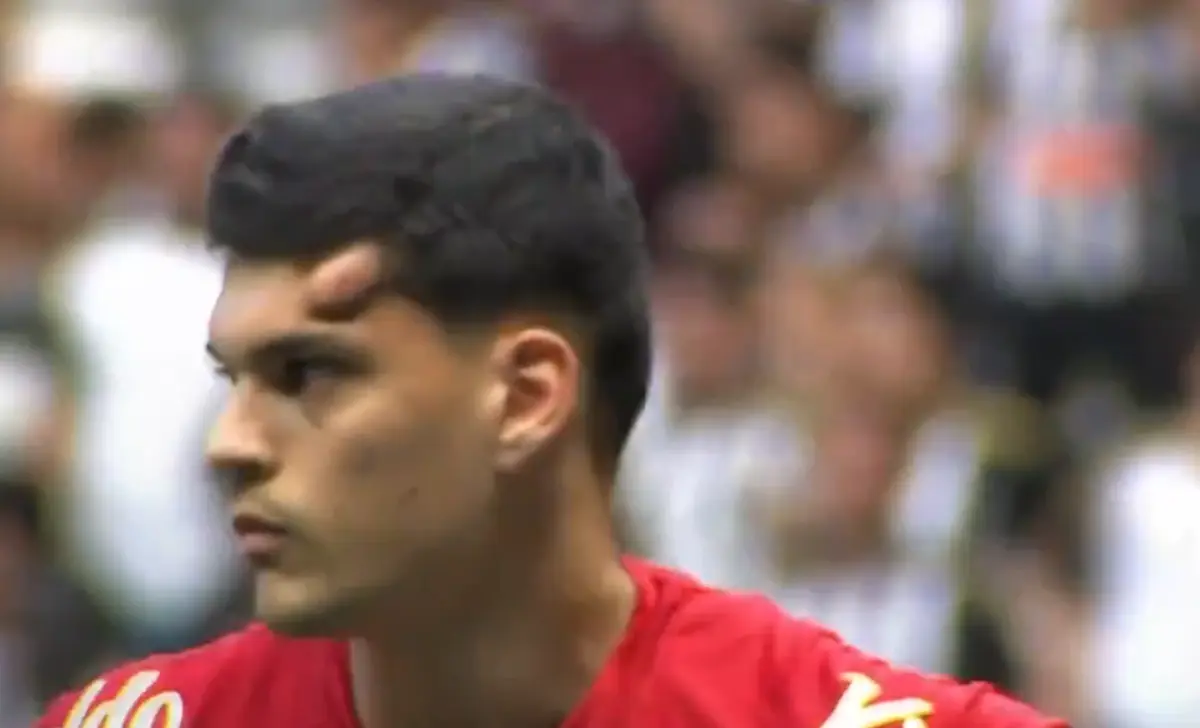 Imagem de contexto do artigo Guarda-redes do Santos ficou com "galo" impressionante após choque com adversário