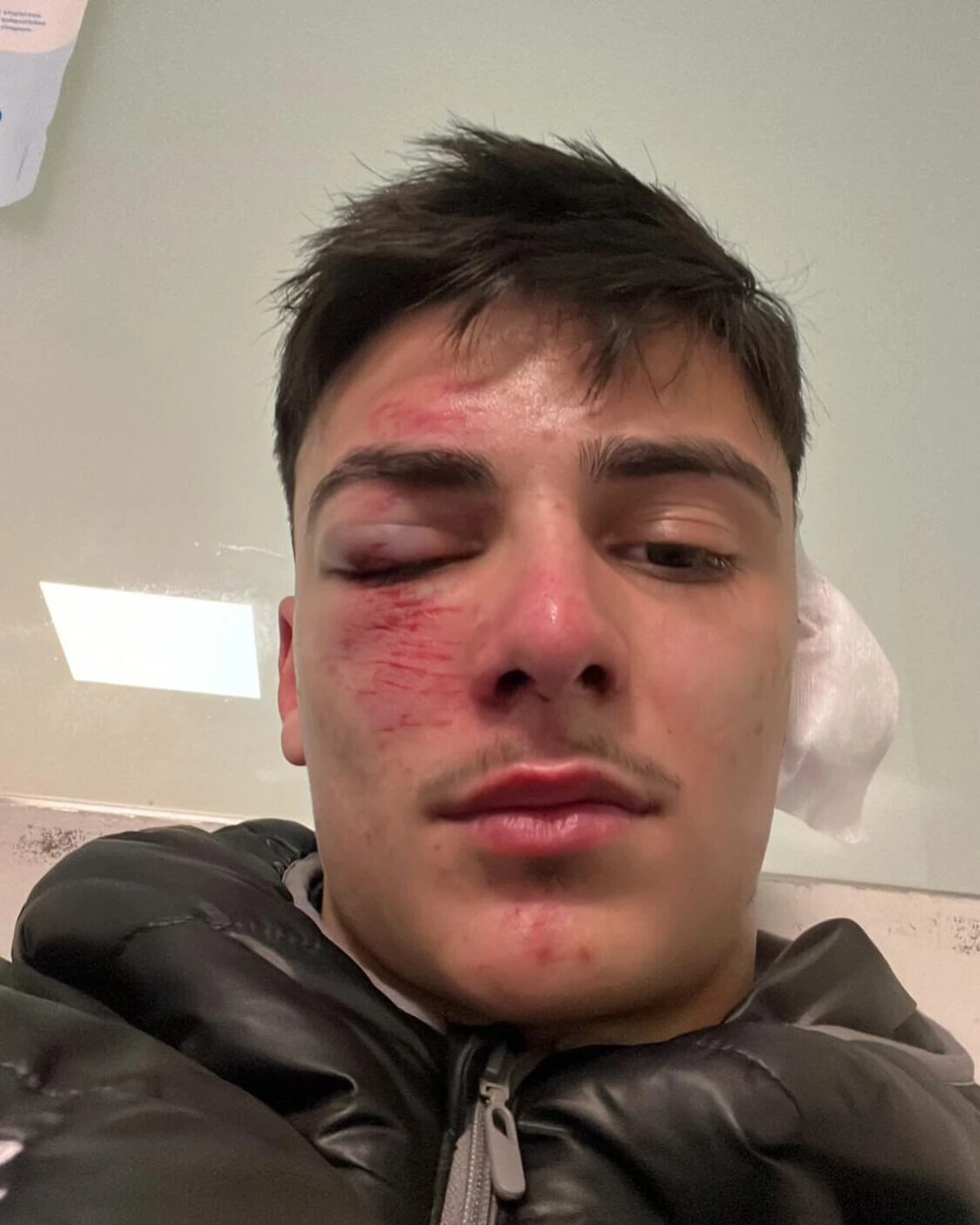 Pedrinhas, do Varziela