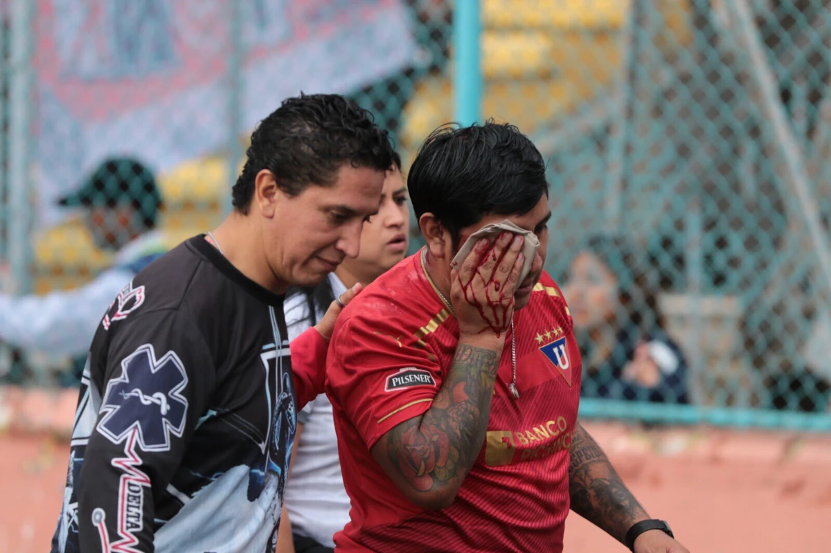 Imagem de contexto do artigo Adepto foi atingido por bala de borracha e ficou sem um olho