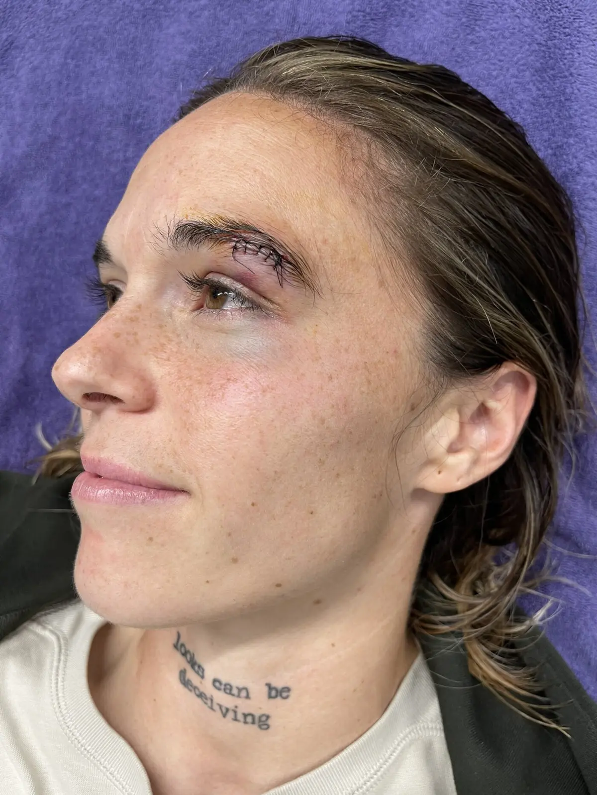 Imagem de contexto do artigo Sobrancelha suturada leva Mapi León a pedir VAR no futebol feminino espanhol